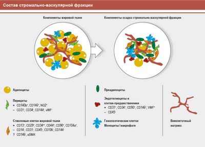 Аутологичные стромальные клетки, полученные из жировой ткани, могут облегчить остеоартрит коленного сустава