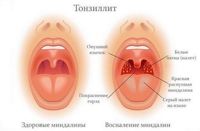 фордайс