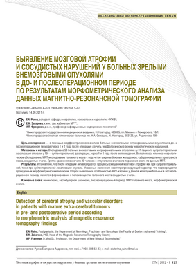 Измерение атрофии головного мозга у пациентов с легкими когнитивными нарушениями